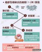 [咽炎怎么样？]